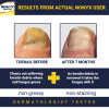 Nonyx Fungal Nail Clarifying Gel Clears Out Keratin Debris Where Nail Fungus Thrives 4 oz - Nonyx